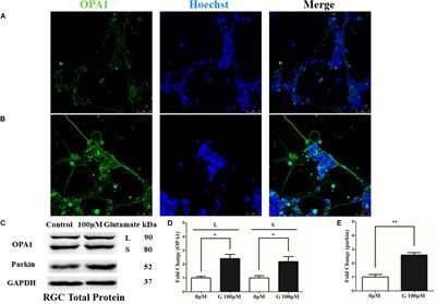 Overexpression of <mark class="highlighted">Optic Atrophy</mark> Type 1 Protects Retinal Ganglion Cells and Upregulates Parkin Expression in Experimental Glaucoma